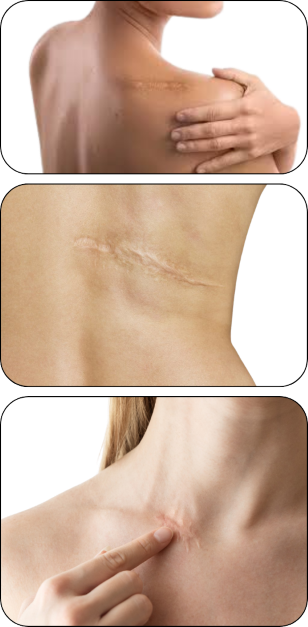 KDerma - Cicatrices - Portada_Opt