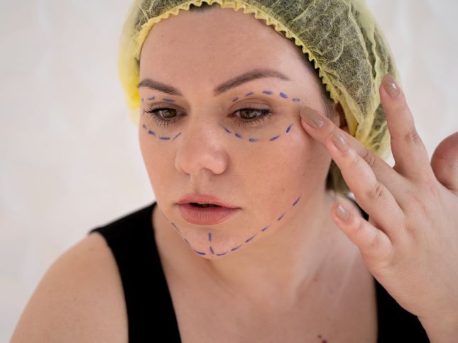 Clínica KDerma - Tratamientos postoperatorios - Cirugia-facial