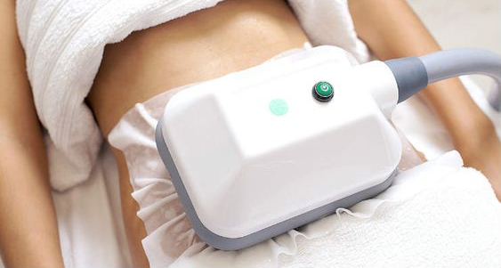 KDerma - Criolipólisis - Tratamiento Reductivo 01