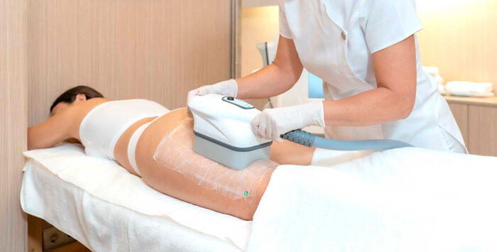 KDerma - Criolipólisis - Tratamiento Reductivo 04