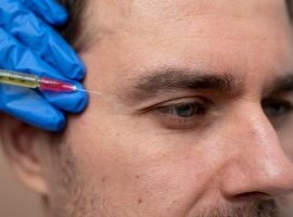 Clínica KDerma - Tratamientos Estéticos Faciales - Ácido Hialurónico Rellenos Dérmicos