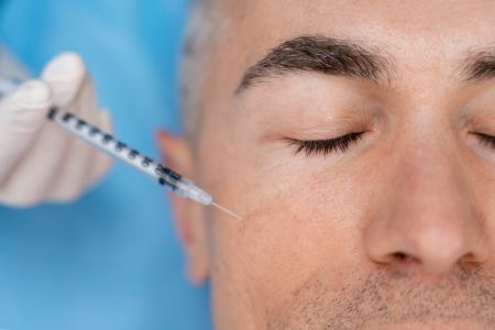 Clínica KDerma - Tratamientos Estéticos Faciales - Ácido Hialurónico_Opt1