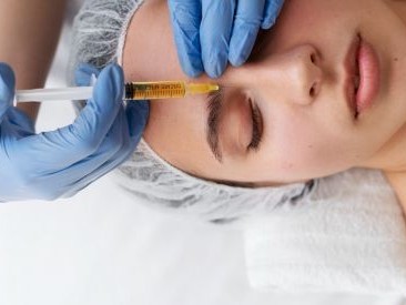 Clínica KDerma - Tratamientos Estéticos Faciales - Bioestimuladores